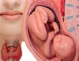 پاورپوینت با عنوان اختلالات تیروئید در بارداری
